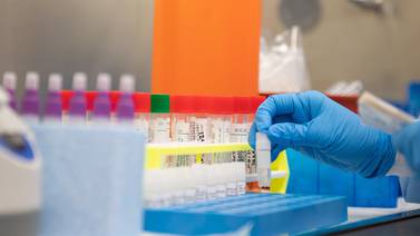 Laboratorios privados del país experimentan alta demanda por pruebas PCR y se preparan para atender a los viajeros
