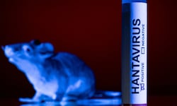 ¿Qué es el hantavirus? Origen, historia y el científico que lo descubrió