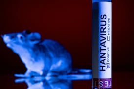 ¿Qué es el hantavirus? Origen, historia y el científico que lo descubrió