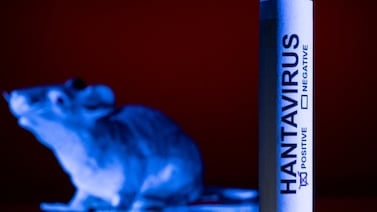¿Qué es el hantavirus? Origen, historia y el científico que lo descubrió