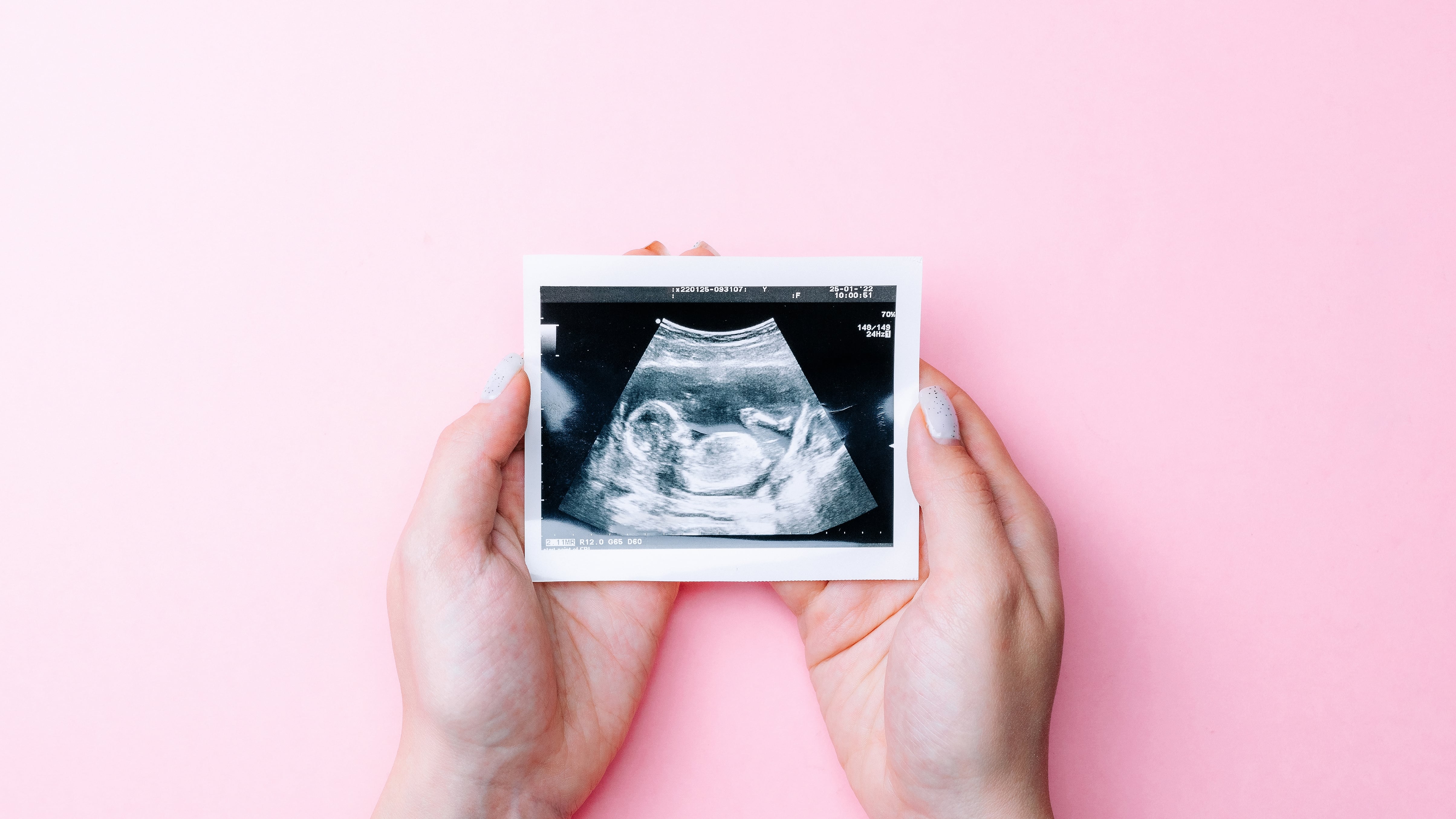 ¿Cómo evoluciona la maternidad en Costa Rica? Esto revelan los datos sobre edad promedio, cantidad de nacimientos por año y perfil educativo