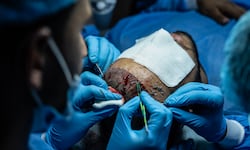 El negocio de la cirugía estética masculina se dispara: intervenciones crecen un 95% globalmente desde 2018