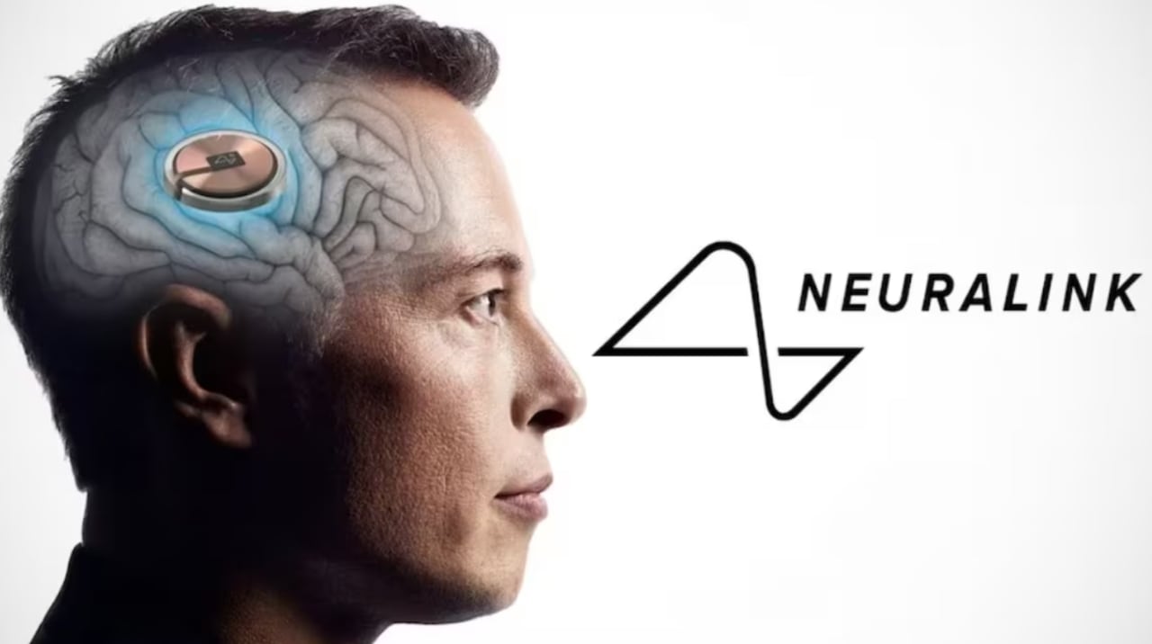 Neuralink es una de las tantas empresas del multimillonario Elon Musk. Foto: Brand Vision Marketing.