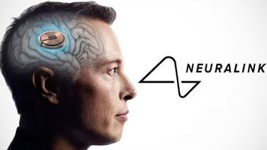Investigadores dudan de la promesa de Elon Musk para restaurar la vista con un implante cerebral