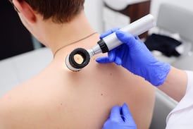Moderna y Merck anuncian resultados positivos de una vacuna contra el cáncer de piel