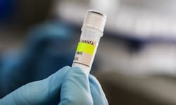 Caso hantavirus: la OMS clasifica a todos los pasajeros del barco afectado como “contactos de alto riesgo”, pero llama a la calma