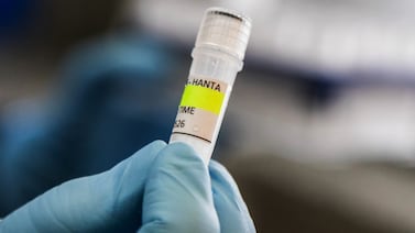 Caso hantavirus: la OMS clasifica a todos los pasajeros del barco afectado como “contactos de alto riesgo”, pero llama a la calma