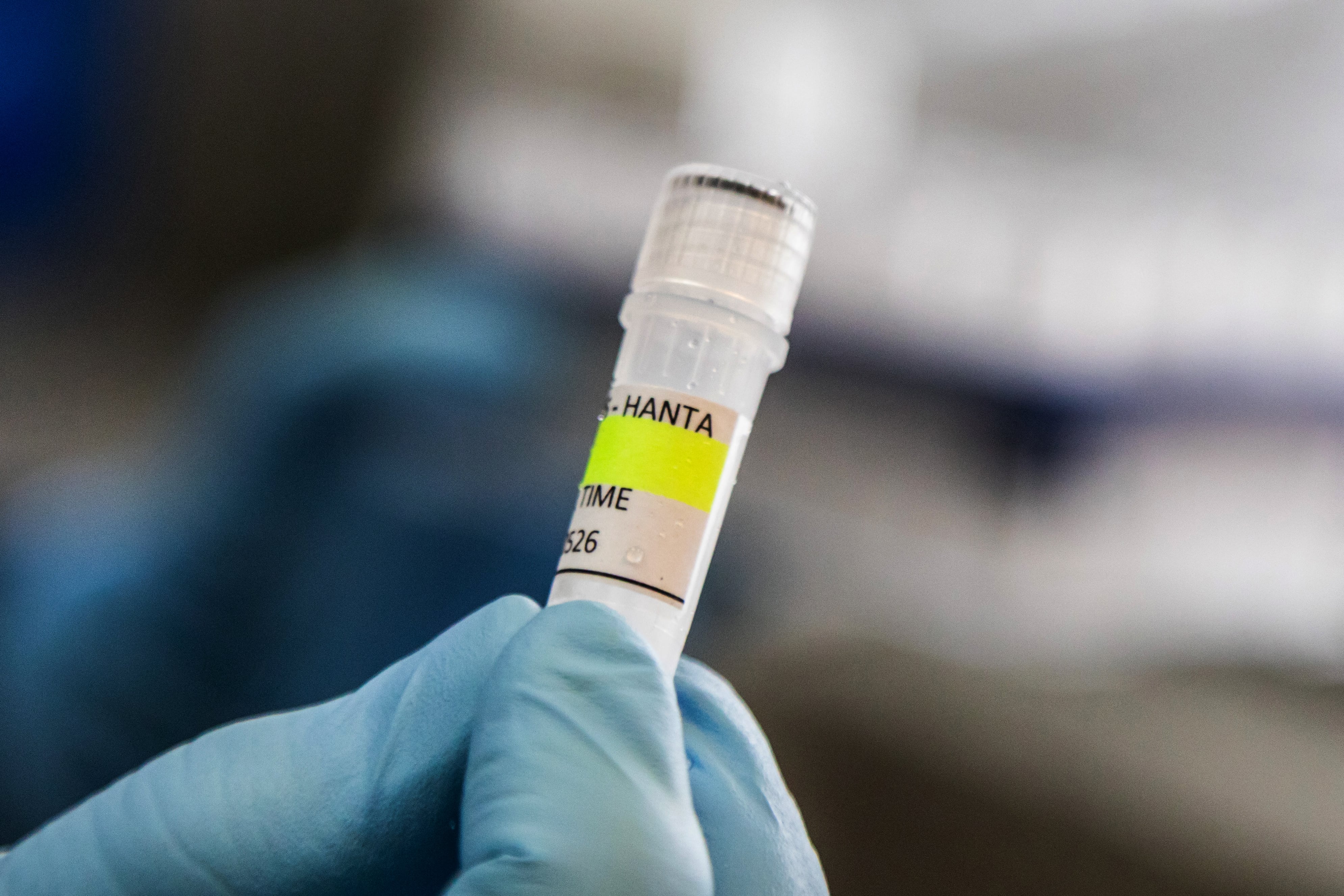 Esta fotografía muestra a un científico del Instituto Malbrín sosteniendo un recipiente utilizado para diagnosticar el hantavirus andino