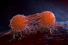 Fármacos de nueva generación rompen 40 años de estancamiento frente al cáncer de páncreas